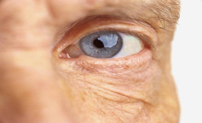 How Diabetic Retinopathy Affects Vision in Older Adults close up of older persons eye